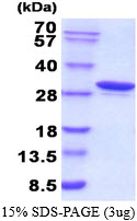 3 μg by SDS-PAGE under reducing condition and visualized by coomassie blue stain.